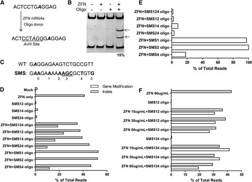 Figure 2. Correction at the β-globin locus in CD34+ cells using an oligonucleotide donor. (A) Schematic of oligonucleotide-directed gene modification. The top sequence is the genomic DNA of the β-globin locus with the site of the sickle mutation in bold and italicized. The sequence of the modified locus is shown on the bottom with the inserted bases shown in italics. (B) Gene modification in mPB CD34+ cells with an oligonucleotide donor. PAGE of an AvrII-digested PCR amplicon of the β-globin locus. The fragment contains a native AvrII site, cleavage of which serves as an internal control for AvrII digestion (the lower band on the gel). Arrows indicate AvrII cleavage products. (C) Six possible sites of silent mutation in the SBS 33501 ZFN binding site. Sickle mutation italicized in bold, and all possible silent mutation sites are in bold (including those not discussed). (D) Silent mutations increase gene modification at β-globin. mPB CD34+ cells were transfected with ZFNs (30 μg/mL) and the indicated donor oligonucleotide (3 μM). Introduction of the relevant silent mutation was assayed via high-throughput sequencing. White bars indicate gene modification; gray bars indicate indels. (E) Silent mutations block ZFN recleavage. Alleles with indels were examined for evidence of homology-mediated modification. Shown are the percentages of alleles with gene modification that also have evidence of NEHJ-driven indels. (F) Optimization of ZFN concentration and donor type. NHEJ-driven indels (gray bars) and gene modification (white bars) were assayed by high-throughput DNA sequencing. Given the depth of high-throughput DNA sequencing, measurement error is expected to be very low.