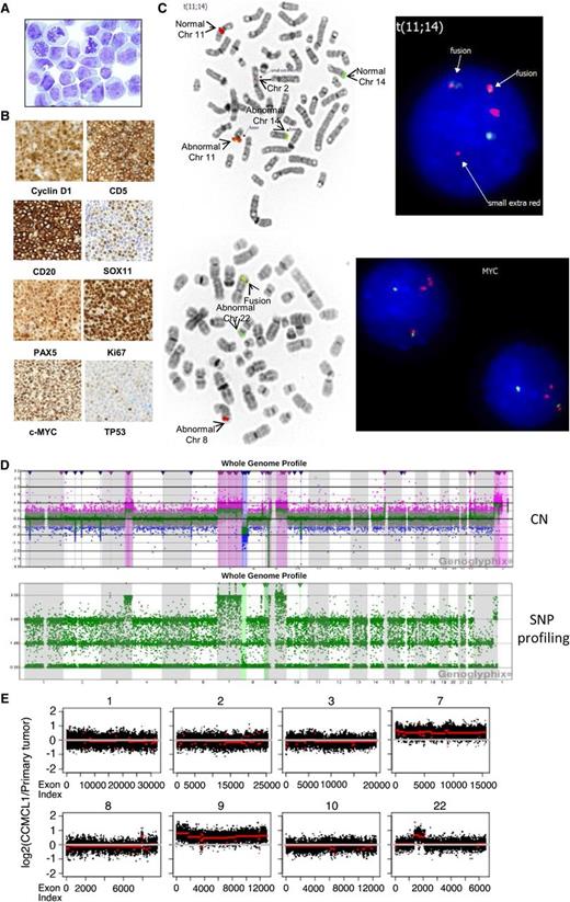 Figure 1. Characterization of CCMCL1 cells. (A) Wright staining (original magnification ×1000) of CCMCL1 cells. (B) An NSG mouse was injected with 10 million first passage CCMCL1 cells via tail vein and sacrificed 5 weeks later. The spleen was collected and fixed in 10% formalin overnight, and a paraffin block was prepared. Immunostaining was performed using an automated stainer. (C) FISH of CCND1 (upper panels) and MYC (lower panels). FISH assay was performed on metaphases with an IGH/CCND1 dual-color, dual-fusion probe set (Abbott Molecular, Des Plaines, IL). Rearrangement of the MYC locus (8q24) was tested with the Break Apart probe from Abbott Molecular. FISH data were analyzed with ASI software. (D) Comparative genomic hybridization (CGH) + single nucleotide polymorphism (SNP) array (detailed information available in supplemental Methods, found on the Blood Web site). Upper panel: chromosome copy number (CN); lower panel: SNP profiling. The log ratio and allele difference plots are shown on the y-axis. (E) Whole-exome sequencing and CNV analysis were performed as described elsewhere.2 The duplication or amplification of specific chromosome regions in CCMCL1 cells (red line) compared with primary tumor cells (white line) was shown. The complete CNV analysis is shown in supplemental Figure 3. Chr, chromosome.