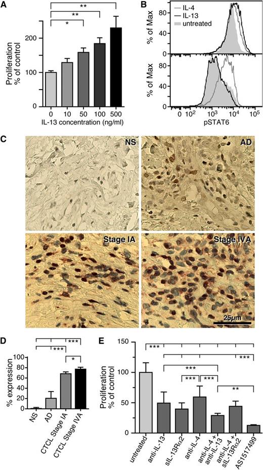 Figure 3. Blocking the IL-13–signaling pathway inhibits SS CD4+ T-cell proliferation. (A) Freshly isolated CD4+ T cells from SS patients were cultured in vitro for 5 days and treated with 10, 50, 100, or 500 ng/mL of IL-13. Proliferation was determined by MTT assay and data are depicted as means ± SD compared with untreated cells. Statistics were gathered by ANOVA followed by post hoc Dunnett test. (B) CD4+ T cells from SS patients (upper panel) or NDs (lower panel) were treated for 15 minutes with IL-4 or IL-13 and pSTAT-6 was determined by intracellular staining as described in Material and methods. Shown is a representative example of 5 independent experiments giving similar results. (C) Immunohistochemical analysis of pSTAT-6 from NS (n = 3), AD skin (n = 3), and stage I (n = 4) and stage IV (n = 4) CTCL skin biopsies. Representative examples are shown (original magnification ×400). (D) The percentages of pSTAT-6+ cells after quantification of 20 HPF for each sample are shown. Error bars are mean ± SD. Statistics were gathered by ANOVA followed by post hoc Tukey test. (E) Effect of a soluble IL-13Rα2 (2.5 μg/mL), an anti-IL-13 antibody (6.5 μg/mL), an anti-IL-4 antibody (10 μg/mL), or a pSTAT-6 inhibitor (AS1517499, 100 nM) on SS CD4+ T-cell proliferation. The proliferation inhibition rate was detected by MTT assay after 5 days in culture; the data are shown as means ± SD; ***P < .001 compared with the untreated cells. Statistics were gathered by ANOVA followed by post hoc Tukey test.