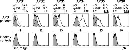 Figure 3. β2GPI complexed with HLA class II molecules is recognized by autoantibodies in APS patients. Autoantibody binding to β2GPI bound to HLA class II in aPL antibody-positive and -negative APS patients and healthy controls. Diluted sera were mixed with cells transfected with β2GPI and HLA-DR7, and IgG Ab binding to the cells was assessed (open histogram). Cells transfected with GFP alone were stained as a control (shaded histogram). Levels of aCL antibody-IgG, anti-β2GPI antibody-IgG, and lupus anticoagulant (LA) of each sample are indicated. Levels above the normal ranges (aCL antibody-IgG, 18.5 IgG phospholipid; anti-β2GPI antibody-IgG, 2.2 U; LA, 1.3) are indicated in bold underlined numbers. N.D., not detected. Data are representative of at least 3 independent experiments.