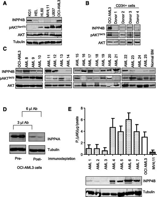 Figure 3. INPP4B is catalytically active but not coupled to pAKTS473 inhibition in AML. Immunoblotting analysis of INPP4B and pAKTS473 in (A) AML cell lines and (B) CD34+ sorted progenitors derived from normal donors relative to the INPP4B-expressing OCI-AML3 cell line. (C) Analysis of INPP4B and pAKTS473 in patient-derived AML samples relative to OCI-AML3 cells and normal BM. (D) Cell lysates from OCI-AML3 cells were immunodepleted with INPP4A antibody (Ab) to demonstrate removal of INPP4A protein in lysates prior to performing INPP4B enzymatic assays. (E) Endogenous INPP4B expression in primary AML samples relative to PtdIns(3,4)P2 4-phosphatase activity. Lysates were immunodepleted of INPP4A and the capacity for INPP4B to process PtdIns(3,4)P2 and release free phosphate ions (Pi) quantified by a malachite green reporter assay. Results represent the mean ± standard deviation (SD) of 2 independent experiments.