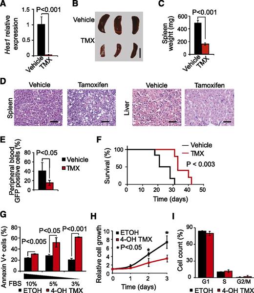 Figure 2. Antileukemic effects of Hes1 inactivation in T-ALL. (A) Quantitative RT-PCR analysis of Hes1 expression across tumor cells isolated from Hes1 conditional knockout T-ALL (ΔE-NOTCH1 Rosa26 Cre-ERT2 Hes1flox/flox)-bearing mice after 24 hours of treatment with vehicle only (n = 3) or tamoxifen (n = 3) in vivo. (B) Representative image of mouse spleens and (C) quantification of spleen weight of Hes1 conditional knockout leukemia-bearing mice treated with vehicle only or tamoxifen for 24 hours. Scale bar represents 1 cm. (D) Hematoxylin and eosin-stained tissue micrographs of liver and spleen sections from Hes1 conditional knockout leukemia-bearing mice treated with vehicle or tamoxifen. Scale bars represent 50 μm. (E) Quantification of leukemia lymphoblasts as percentage of green fluorescent protein-positive cells in Hes1 conditional knockout NOTCH1-induced leukemia-bearing mice treated with vehicle only (n = 6) or tamoxifen (n = 5) in vivo. (F) Kaplan-Meier survival curves of Hes1 conditional knockout NOTCH1-induced leukemia-bearing mice treated with vehicle only (n = 6) or tamoxifen (n = 5) in vivo. (G) Quantification of apoptosis in Hes1 conditional knockout leukemia cells treated with ethanol (ETOH) as control or tamoxifen (4-OH TMX) in vitro. (H) Quantification of cell proliferation in Hes1 conditional knockout leukemia cells treated with vehicle or tamoxifen in vitro. (I) Cell cycle analysis of Hes1 conditional knockout leukemia cells treated with vehicle or tamoxifen in vitro. Bar graphs indicate mean values of triplicate measurements; error bars represent standard deviation.