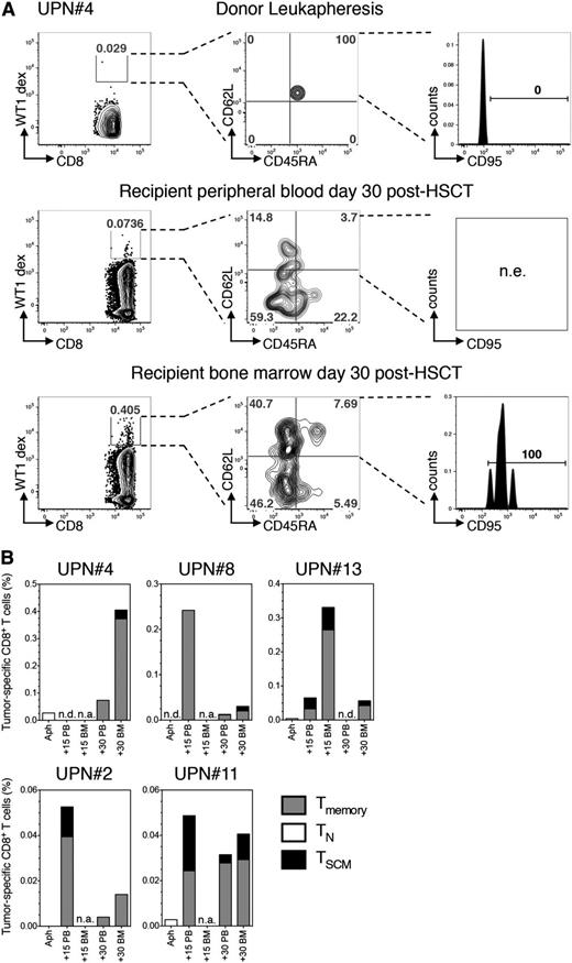 Figure 4. Conversion of CD8+ TN into TSCM can be demonstrated at the antigen-specific level. (A) Identification of WT1-specific CD8+ T cells restricted to the host nonshared HLA-A*0101 by dextramer staining of, from top to bottom, donor LP, day 30 peripheral blood, and day 30 BM harvested from UPN#4. For each point analyzed, left plot depicts the percentage of dextramer-positive CD8+ T cells (WT1-dex). Dextramers carrying the same restriction element but loaded with an irrelevant peptide were used to set the gate and distinguish rare antigen-specific cells from background. Central plot shows CD45RA and CD62L expression on dextramer-positive cells (quadrants are set on the polyclonal CD8+ population). Right plot depicts CD95 expression on CD45RA+CD62L+ cells when detected (CD95 gate is set on the polyclonal CD8+ population). (B) Histograms summarizing the quantification and phenotypic characterization of CD8+ T cells specific for either WT1 (UPN#4, UPN#8, UPN#11, and UPN#13) or PRAME (UPN#2) in 5 patients affected by acute leukemia and with HLA typing suitable for dextramer analysis. For all cytometric dextramer acquisitions, no fewer than 1 × 106 cells were stained and no fewer than 105 events on the CD3+ gate were recorded. n.a., sample not available; n.e., population not evaluable.