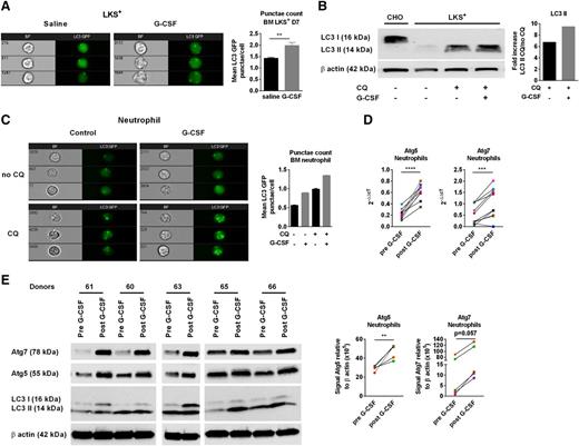 Figure 1. G-CSF induces autophagy in HSCs and neutrophils. (A) Representative images of LC3-GFP punctae formation in sorted BM LKS+ cells from LC3-GFP mice treated with saline or G-CSF. Mean LC3-GFP punctae/cell ± SEM (n = 6-7, 2 experiments). (B) Total cell lysates from LKS+ were immunoblotted with anti-LC3B or anti-β actin. CHO cell lines were used as a control expressing LC3 I. The fold increase of LC3 II band intensities, normalized to β actin, was determined by the ratio of CQ-treated and CQ-untreated cells (representative experiment). (C) LC3-GFP punctae in purified BM neutrophils (CD11b+Gr1hi) culture in duplicate for 6 hours ±G-CSF and ±CQ. LC3-GFP punctae quantification in neutrophils (representative experiment). (D) Blood from human donors were collected before and after 5 days of G-CSF treatment (10 mcg/kg per day). Sorted neutrophils were collected for quantitative real-time polymerase chain reaction analyses and western blot. Relative gene expression of ATG5 and ATG7 from sorted human blood neutrophils before and after G-CSF treatment (n = 10). (E) Total cell lysates were immunoblotted with anti-ATG5, ATG7, LC3, or anti-β actin antibodies. A paired Student t test was performed for statistical analyses (**P < .01, ***P < .001, ****P < .0001). The mean ± SEM is presented. Each dot corresponds to an individual donor. The data before and after G-CSF are color-paired.