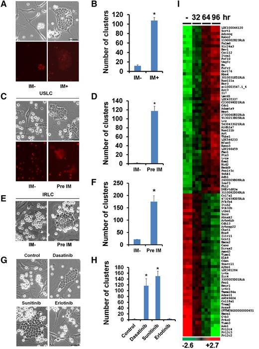Figure 1. IM-induced alterations in OP9 cells promote the interaction between OP9 cells and leukemic cells. (A) Microscopic visualization of cocultured OP9 cells and mCherry-labeled leukemic cells treated with vehicle (IM−) or IM for 4 days (top: phase contrast; bottom: mCherry fluorescence). (B) Quantification of leukemic cell clusters in (A). (C) Microscopic visualization of leukemic cell clusters formed within 2 hours after seeding of mouse BCR-ABL+ ALL cells onto OP9 cells pretreated with the vehicle (IM−) or IM for 4 days (top: phase contrast; bottom: mCherry fluorescence). (D) Quantification of leukemic cell clusters in (C). (E) Microscopic visualization of leukemic cell clusters formed within 2 hours after seeding of IRLCs onto OP9 cells pretreated with the vehicle (IM−) or IM for 4 days. (F) Quantification of leukemic cell clusters in (E). (G) Microscopic visualization of leukemic cell clusters formed within 2 hours after seeding of leukemic cells onto OP9 cells pretreated with a vehicle (control), dasatinib, sunitinib, or erlotinib for 4 days. Note that, like IM, dasatinib and sunitinib are TKIs, whereas erlotinib is an epidermal growth factor receptor inhibitor. (H) Quantification of leukemic cell clusters in (G). (I) Heat map showing the top 100 differentially expressed genes in OP9 cells treated with a vehicle (−) or IM for 32, 64, or 96 hours. Scale bars, 50 µm. Data are shown as the mean ± SEM. *P < .05 as determined by Student t test.