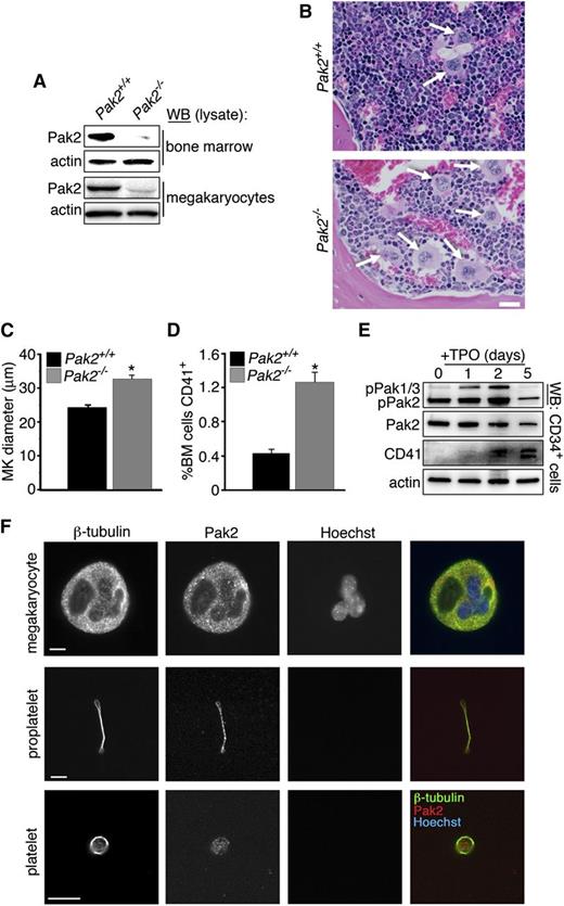 Figure 1. Pak2 deletion stimulates megakaryopoiesis in vivo. (A) WB to detect Pak2 levels in bone marrow (top) and megakaryocytes (bottom) 14 DPI. Actin serves as a loading control for relative protein levels. Megakaryocytes lysates collected from cultured bone marrow of pIpC-injected Mx1-cre+;Pak2fl/fl and wild-type (notated as (Pak2−/− and Pak2+/+, respectively) mice at 14 DPI. (B) Representative bone marrow histology from Pak2+/+ and Pak2−/− mice (n = 5 mice/genotype), both treated with plpC and analyzed 14 DPI. White arrows indicate megakaryocytes. Scale bar = 20 μm (×40 original magnification). (C) Measurement of megakaryocyte diameter in the bone marrow (n = 5 mice/genotype). (D) Percentage of bone marrow expressing CD41 measured by flow cytometry. (E) CD34+ bone marrow stem cells sorted by flow cytometry and cultured with 100 ng/mL TPO for 5 days. Representative WB of phospho-Pak1/2/3 (Serine141) and Pak2 expression during a 5-day time course. Actin serves as a loading control for total protein levels. CD41 expression marks mature megakaryocytes. (F) Fluorescence microscopy of megakaryocyte (top), proplatelet (middle), and platelet (bottom) stained for β1-tubulin, Pak2, and nuclei (Hoechst). Scale bar = 10 μm. All values are mean ± standard error of the mean (SEM) for at least 5 mice/genotype. *P < .05.