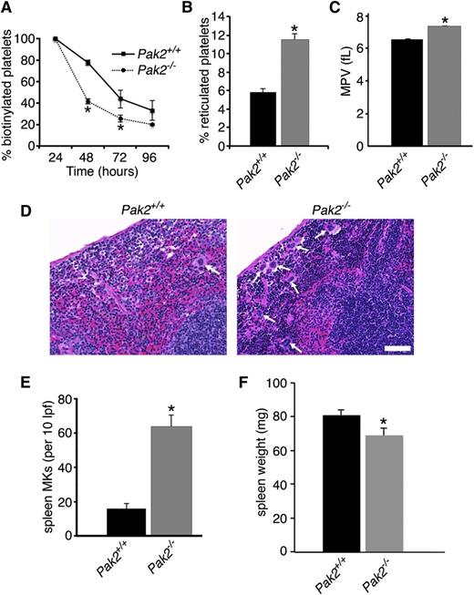Figure 2. Clearance rate and production of platelets is increased in Pak2-null mice. (A) Quantification of in vivo biotinylated platelets 24, 48, 72, and 96 hours after N-hydroxysulfosuccinimidobiotin-biotin injection. Data expressed as percentage of baseline (24 hours postinjection; n = 4-8 mice/genotype per time point; mean ± SEM). (B) Quantification of the percentage of new, reticulated platelets as a percentage of total platelets (n > 5; mean ± SEM), 10 DPI. (C) MPV of Pak2+/+ and Pak2−/− platelets, 14 DPI. (D) Representative images of hematoxylin and eosin stained spleen sections from Pak2+/+ and Pak2−/− mice 14 DPI. Arrows indicate splenic megakaryocytes. Scale bar = 50 μm (40× original magnification). (E) Quantification of megakaryocytes in spleen sections counted in 10 low-power fields. (F) Spleen weight (mg) 14 DPI. All data from at least 3 mice/genotype; mean ± SEM. *P < .05.