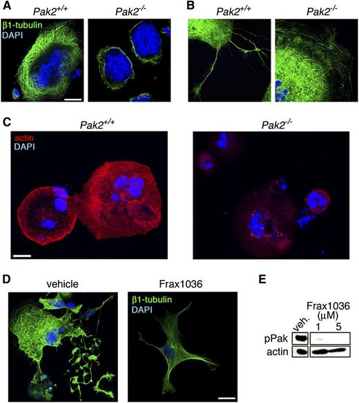 Figure 5. Altered cytoskeleton structure in Pak2-null megakaryocytes. (A) Analysis of β1-tubulin structure and (B) proplatelet structure by fluorescence microscopy of wild-type and Pak2−/− megakaryocytes adhered to fibrinogen for 5 hours. Bone marrow treated with 500 nM 4-hydroxytamoxifen to induce Cag-Cre-ERT2 expression and delete Pak2fl/fl. Representative image of β1-tubulin (green) and DAPI nuclear (blue) staining from 3 mice per genotype. (C) Representative Alexa Fluor 594-phalloidin staining for actin (red) and DAPI (blue) analyzed by fluorescence microscopy of wild-type and Pak2−/− megakaryocytes adhered to collagen for 5 hours. (D) Fetal liver-derived megakaryocytes treated with Frax1036 for duration of culture (4 days) and stained for β1-tubulin (green) and DAPI (blue). (E) Western blot detection of serine 141 phosphorylated Pak1/2/3 (pPak) of fetal liver-derived megakaryocytes treated with Frax1036. Actin serves as a control for protein loading. Scale bar = 20 μm for all images.