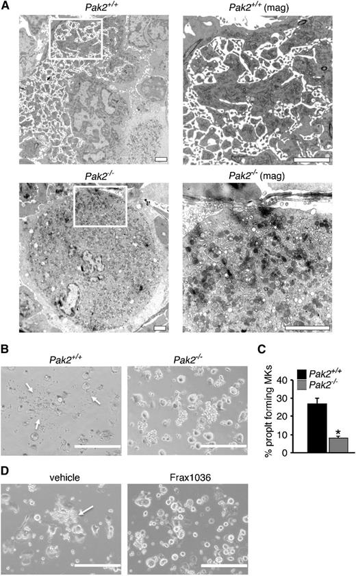 Figure 6. Decreased proplatelets and altered ultrastructure of Pak-null megakaryocytes. (A) Bone marrow imaged for megakaryocytes from wild-type and Mx1cre+Pak2−/− mice analyzed by transmission electron microscopy, 14 DPI. Wild-type megakaryocyte (upper, left, ×5000), periphery magnified (upper, right, ×12 000). Pak2−/− megakaryocyte (lower, left, ×5000), periphery magnified (lower, right, ×20 000). Scale bar = 2 μm. (B) Proplatelet formation imaged from cultured megakaryocytes from wild-type and Cag-Cre-ERT2+Pak2−/− bone marrow, induced with 500 nM 4-hydroxytamoxifen and adhered to fibrinogen. White arrows indicate proplatelet. (C) Percentage proplatelet-forming megakaryocytes expressed as a percentage of total megakaryocytes per visual field ± SEM, n = 5/genotype. Scale bar = 200 μm. *P < .05. (D) Representative image of proplatelet formation in vehicle and Frax1036-treated bone marrow-derived megakaryocytes. Scale bar = 200 μm. White arrows indicate proplatelet.