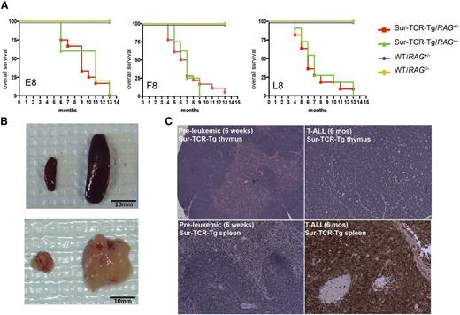 Figure 2. Sur-TCR-Tg mice develop lethal leukemia. (A) Leukemia developed in progeny of all 3 founders beginning at 4 to 6 months, with equivalent latency and penetrance in Sur-TCR-Rag+/− and Sur-TCR-Rag−/− mice. (B) T-ALL mice (right) had enlarged spleens (top) and thymi (bottom) at necropsy compared with WT mice (left). (C) Hematoxylin and eosin (H&E) staining of thymus (top), and anti-TdT immunohistochemistry of spleen (bottom) in preleukemic 6-week-old Sur-TCR-Tg mice (left) and T-ALL 6-month-old Sur-TCR-Tg mice (right) (×50 magnification). T-ALL mice show complete effacement of the affected organs. (B-C) Examples from 1 representative mouse, and similar results were observed in >6 animals of each type.