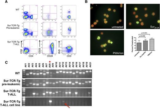 Figure 3. T-ALL in Sur-TCR-Tg mice is composed of transformed thymocytes that express and signal via the transgenic TCR. (A) Flow cytometry of splenocytes harvested from representative WT, Sur-TCR-Tg preleukemic mice (∼6 weeks of age), and Sur-TCR-Tg T-ALL mice. T-ALL cells consistently express CD3, CD24, and TRBV8, usually express CD25 and typically do not express CD4 or CD8. Similar results were observed in at least 3 separate experiments involving >6 animals of each type. (B) Sur-TCR-Tg T-ALL signal in response to the Sur20-28 peptide. T-ALL cell lines derived from a representative Sur-TCR-Tg leukemic mouse were transduced with NFAT-eGFP, then exposed to the irrelevant control E7 peptide, Sur20-28, or PMA/Ca ionophore. Nuclear translocation of NFAT-eGFP as identified via microscopy is shown in a representative field (immunofluoresence images) and data are summarized from 10 fields for each condition. Four independent experiments using 2 separate T-ALL cell lines were tested with similar results. (C) TRAV gene expression in representative WT and Sur-TCR-Tg preleukemic mice reveal a diverse repertoire. T-ALL harvested from spleen of a representative T-ALL mouse expresses an oligoclonal repertoire of TRAV genes, whereas a cell line derived from leukemic splenocytes is clonal, as evidenced by a single native TRAV gene (TRAV12 arrow). Preleukemic spleen, leukemic spleen, and the T-ALL cell lines (but not WT) express the transgenic TRAV8, designated with a star. This experiment was repeated at least 3 times using 3 different leukemic and WT animals as well as 3 separate leukemic lines with similar results.