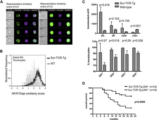 Figure 5. Signaling via the survivin-reactive TCR contributes to leukemogenesis. (A) Cell images taken from 4 separate cells designated as “high similarity scores” vs “low similarity scores” are shown. Cells with high similarity scores were from Sur-TCR-Tg mice and cell with low similarity scores were from WT controls. (B) Thymocytes from 6-week Sur-TCR-Tg (black) and WT (gray) mice were harvested and stained immediately using cell-surface antibodies, then fixed/permeabilized and stained with intracellular NFAT antibody. Lin− cells were gated and the frequency of DN thymocytes from Sur-TCR-Tg+ (black) and WT (gray) exhibiting nuclear translocation of NFAT is shown using the NFAT/DAPI similarity score histogram overlay. Representative result from 1 mouse is shown for each condition. In this analysis, a larger score indicates a greater degree of signal correlation between NFAT channel and nuclear channel and thus, translocation. Translocated cells are defined as those with a similarity score above 1. Similar results were seen in >2 separate experiments containing at least 3 animals per group. (C) Thymocytes with NFAT nuclear translocation (similarity score > 1.0) by ImageStreamX analysis in thymocyte subsets of Sur-TCR-Tg mice, compared with WT mice (top). Among the DN subsets, Sur-TCR-Tg showed significantly more NFAT nuclear translocated cells in DN2 and DN4 subset compared with WT mice (bottom). Similar results were obtained in 2 separate experiments with at least 3 animals per group. (D) Sur-TCR-Tg mice were bred with β2M−/− mice to generate Sur-TCR-Tg+ β2M−/− mice, then animals were monitored for the development of T-ALL for 20 months. Kaplan-Meier analysis reveals significantly diminished death due to T-ALL in Sur-TCR-Tg+ β2M−/− mice compared with those Sur-TCR-Tg+β2M+/− mice (P = .006).