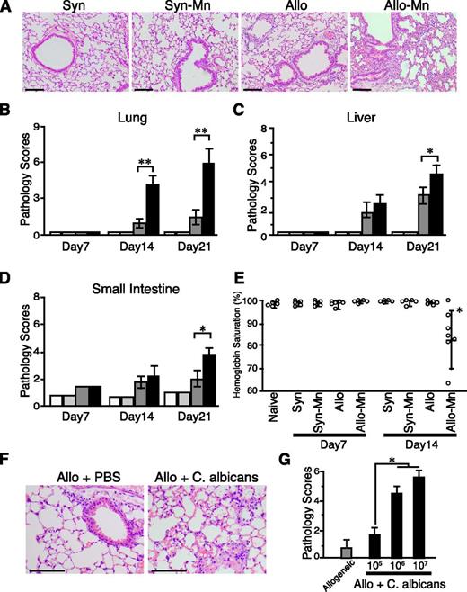 Figure 2. Mn and C albicans exaggerated GVHD pathology. BMT were performed as shown in Figure 1A. (A) The representative images of the lungs stained with hematoxylin and eosin on day 21 after syngeneic (Syn) and allogeneic (Allo) BMT with or without Mn treatment are shown. Pathology scores of the lung (B), liver (C), and small intestine (D) from Syn controls (white bars), Mn-treated Syn mice (light gray bars), Allo controls (dark gray bars), and Mn-treated Allo mice (black bars) of 3 independent experiments were combined (n = 5 per group, means ± standard error). (E) Peripheral arterial oxygen saturation levels from 2 independent experiments are combined and means ± standard error are shown. (F-G) Allogeneic recipient mice were intraperitoneally injected with 1 × 105, 1 × 106, or 1 × 107 of heat-killed C albicans on the day of BMT. (F) The representative images of the lungs stained with hematoxylin and eosin on day 14 after allogeneic (Allo) BMT with or without the injection of 1 × 107 C albicans are shown. (G) Bar graph shows pathology scores of the lung from Allo controls (dark gray bars) and Allo mice treated with indicated doses of C albicans (black bars) are shown. Data from 1 of 2 independent experiments were shown (n = 3-5 per group, means ± standard error). Original magnification ×200. Scale bars represent 100 μm (A,F). *P < .05; **P < .01.