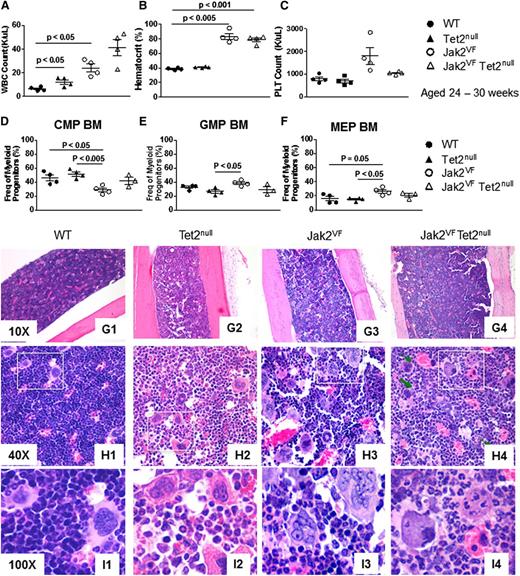 Figure 2. Tet2 loss influences hematopoietic differentiation within the myeloid progenitor compartment of Jak2V617F mice but is insufficient to induce leukemic transformation. (A-C) White blood cell (WBC) count, hematocrit, and platelet (PLT) count of age-matched WT, Tet2null, Jak2VF, and Jak2VF/Tet2null mice 24 to 30 weeks old (mean ± SEM; n = 4 in each group). (D-F) Relative frequency of common myeloid progenitor (CMP), granulocyte macrophage progenitor (GMP), and megakaryocyte erythroid progenitor (MEP) cells in bone marrow from age-matched WT, Tet2null, Jak2VF, and Jak2VF/Tet2null mice (mean ± SEM; n = 4 in each group). (G-I) Histopathologic sections of bone marrow from representative WT, Tet2null, Jak2VF, and Jak2VF/Tet2null mice (original magnifications ×10 for G1-G4, ×40 for H1-H4, and ×100 for I1-I4; H&E stain).