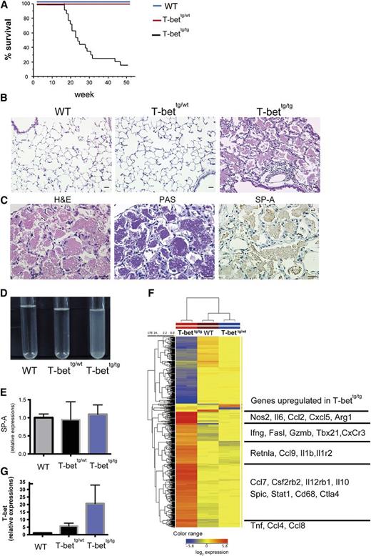 Figure 1. Aged T-bettg/tg mice spontaneously develop PAP-like disease. (A) Kaplan-Meier plot showing survival among mice with the indicated genotypes (n = 20 in each group). (B) Representative photomicrographs of the lungs of 50-week-old WT, T-bettg/wt, and T-bettg/tg mice. Alveolar spaces in T-bettg/tg mice are filled with acellular eosinophilic material and show inflammatory cell infiltration. H&E staining; bars = 100 µm. (C) Photomicrographs of lung sections from T-bettg/tg mice. The alveolar material is positive for PAS staining and for immunohistochemical staining of mouse SP-A. Bars = 100 µm. (D) Appearance of BAL fluid from 50-week-old WT, T-bettg/wt, and T-bettg/tg mice. (E) Levels of SP-A expression levels in lungs from 50-week-old WT, T-bettg/wt, and T-bettg/tg mice (n = 4 in each group). (F) The heat-map of genes whose expression changes are >10-fold between the genotypes in lung mRNAs. (G) Levels of T-bet mRNA expression levels in lungs from 50-week-old WT, T-bettg/wt, and T-bettg/tg mice (n = 4 in each group).