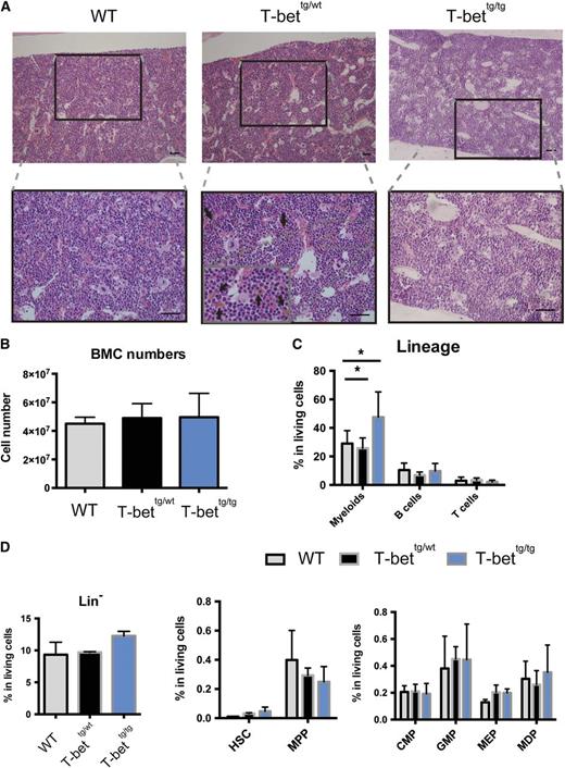 Figure 4. Distinct BM abnormalities in T-bet tg mice. (A) H&E staining of BM sections (femur) prepared from 30-week-old mice with the indicated genotypes. Arrows indicate yellowish-brown macrophages extensively engulfed erythrocytes. Bar = 100 µm. (B) Total numbers of cells in BM from mice with the indicated genotypes. Results are means ± SD; n = 3, 3, and 6. (C) Percentages of myeloid cells, B cells, and T cells in total living BMCs from 30- to 50-week-old mice with the indicated genotypes. Results are means ± SD; n = 8, 4, and 7. *P < .05 (1-way ANOVA, followed by Tukey’s multiple comparisons tests). (D) Percentages of each hematopoietic stem and progenitor compartment in BM from 30- to 50-week-old mice with the indicated genotypes. Results are means ± SD; n = 3 each. CMP, common myeloid progenitors; GMP, granulocyte-macrophage progenitors; MDP, macrophage and dendritic cell progenitors; MEP, megakaryocyte-erythroid progenitors; MMP, multipotent progenitors.