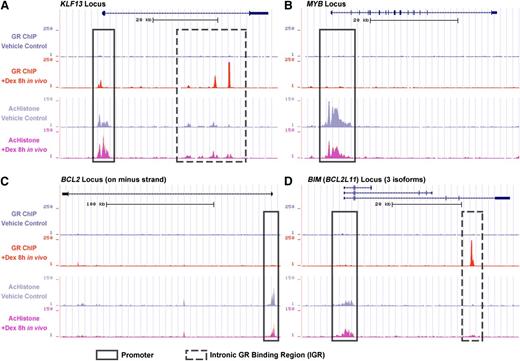 Figure 3. ChIP-seq data of GR binding and histone acetylation. ALL-54 engrafted mice were treated with dexamethasone 15 mg/kg or vehicle control and cells were harvested after 8 hours. ChIP sequencing identified GR binding and histone acetylation on the (A) KLF13 locus, (B) MYB locus, (C) BCL2 locus, and (D) BIM locus as determined using the University of California Santa Cruz Genome Browser. The frames with solid lines refer to promoter regions and downstream regions near the transcription start site. The frames with dashed lines refer to the intronic/distal GR binding regions. Dex, dexamethasone; AcHistone, histone acetylation.