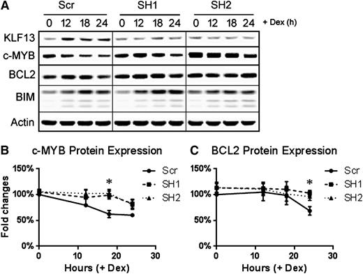 Figure 5. KLF13 knockdown in Nalm6 cells. Nalm6 cells were transduced with either scrambled shRNA or 2 distinct KLF13 shRNAs using lentivirus. (A) Time course of KLF13, c-MYB, BCL2, BIM, and Actin protein expression following 1 µM dexamethasone treatment in vitro. (B) Quantified expression of c-MYB normalized to actin and then to Scr 0-hour samples. N = 3; *P < .05. (C) Quantified expression of BCL2 normalized to actin and then to Scr 0-hour samples. N = 3; *P < .05. Dex, dexamethasone; Scr, scrambled shRNA; SH1, KLF13 shRNA 1; SH2, KLF13 shRNA 2.