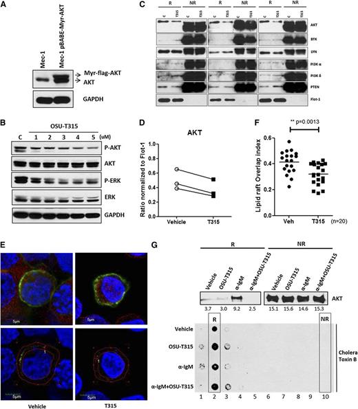 Figure 4. OSU-T315 impairs AKT translocation to lipid raft subdomains in plasma membrane. (A) Mec-1 cells were retro-virally transduced with pBABE-Myr-flag-AKT vector (Addgene). The total lysates were subjected to western blot to verify the myristoylated AKT expression. (B) Mec-1 expressing Myr-flag-AKT was treated with increasing concentration of OSU-T315. Total lysate was analyzed by immunoblotting. (C) Lipid raft from Mec-1 cells expressing Myr-flag-AKT was purified after vehicle or OSU-T315 (4 μM) treatment by the ultracentrifugation approach. The raft (R) and nonraft (NR) fractions were analyzed for raft-associated molecules, and Flotillin-1 serves as a lipid raft marker. (D) The 3 independent studies were quantified for AKT content in raft compartment. (E) Mec-1 cells with Myr-flag-AKT were subject to immunofluorescence staining with antibodies of α-AKT (Alexa 594) and α- Cholera toxin subunit B (CT-B) (Alexa 488). (F) The colocalization index was measured and analyzed by confocal microscope double blindly. (G) 697 cells were treated with plate-bounded α-IgM, 4 μM OSU-T315, or in combination for 1 hour, and the lipid raft fractions were extracted for analysis. Cholera toxin subunit B (CT-B) is the marker for lipid raft compartment.