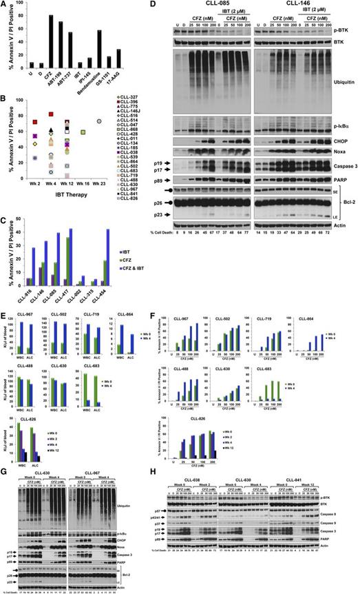 Figure 1. Biological and molecular consequences of adding CFZ to IBT in primary CLL lymphocytes. Peripheral blood was obtained from CLL patients who were either IBT-naive or undergoing IBT therapy and who had given written informed consent in accordance with the Declaration of Helsinki and under a protocol approved by the Institutional Review Board of The University of Texas MD Anderson Cancer Center. PBMCs were separated by Ficoll-Hypaque density centrifugation (Atlanta Biologicals). Cells were cultured at 1 × 107/mL in complete RPMI medium containing 10% human serum and were either untreated or treated with the indicated dose of drugs. (A) Pharmacological screening of IBT-treated CLL cells with 8 therapeutic agents. CLL cells isolated from a patient treated with IBT for 12 weeks were left untreated or were incubated for 24 hours with vehicle (DMSO) or the indicated agents at which point cell death was assessed by annexin V/PI double positivity. For apoptosis assay, 1 × 106 cells were stained with annexin V (BD Biosciences) and PI (Sigma) and analyzed by flow cytometry as previously described.7 CFZ (50 nM, proteasome inhibitor; Selleck Chemicals); ABT-199 (5 nM, Bcl-2 antagonist; Xcess Biosciences); ABT-737 (5 nM, Bcl-2 and Bcl-xL antagonist); IBT (5 μM, BTK inhibitor; Selleck Chemicals); IPI-145 (2.5 μM, PI3Kδ/γ inhibitor); bendamustine (30 μM, alkylating agent); GS-1001 (5 μM, PI3Kδ inhibitor); 17-AAG (5 μM, HPS90 inhibitor; Sigma). (B) Ex vivo cytotoxicity of CFZ in CLL cells post-IBT therapy. PMBCs were isolated from 23 CLL patients who had received IBT for the indicated weeks and were then incubated with CFZ (50 nM) for 24 hours; cell death was assessed by annexin V/PI double positivity (percentage of cell death from DMSO treatment was subtracted from all samples). (C) In vitro cytotoxic effect of IBT, CFZ, or their combination. PBMCs from 7 patients diagnosed with CLL were incubated for 16 hours with CFZ (50 nM) or IBT (2 μM) alone or in combination and cell death was then evaluated by annexin V/PI staining (percentage of cell death from DMSO treatment was subtracted from all samples). (D) Impact of IBT, CFZ, or their combination on the expression level of different proteins. PBMCs from 2 patients with CLL were isolated and treated with the indicated concentrations of CFZ only or in combination with IBT for 16 hours and cell death was assessed by annexin V/PI double positivity (bottom numbers). Treated cells at 16 hours were collected, lysed, and the cell lysates were subjected to immunoblot analysis with the indicated antibodies. Immunoblot analysis was performed as previously described8 by using the following antibodies: phospho-BTK (Tyr223), BTK, phospho-IκBα (Ser32/36), C/EBP homologous protein (CHOP), cleaved poly(ADP-ribose) polymerase (PARP), and cleaved caspase 3 from Cell Signaling Technology; ubiquitin (Santa Cruz Biotechnology Inc); Noxa (EMD Millipore); β-actin (Cytoskeleton Inc); and Bcl-2 (DAKO). Arrows and rounded arrows indicate cleaved and full-length forms, respectively, of the indicated proteins. (E) Impact of IBT therapy on peripheral WBC count and lymphocyte count. WBC count (K/μL) and ALC (K/μL) were plotted for 8 CLL patients prior to (week 0) and 4 weeks (week 4) or 2 (week 2), 4, and 12 (week 12) weeks (CLL-826) after the initiation of IBT treatment. (F) Comparison of CFZ-induced apoptosis in CLL cells pre- and post-IBT therapy. PBMCs from 8 patients were isolated at baseline (week 0) and after 4 weeks (week 4) or after 2, 4, and 12 weeks (CLL-826) of IBT therapy and treated with the indicated concentrations of CFZ (nM). Cell death was measured by annexin V/PI staining at 24 hours or 16 hours (CLL-826) (percentage of cell death from DMSO treatment was subtracted from all samples). No correlation could be made between prognostic markers (Table 1) and CFZ cytotoxic response. (G) Comparison of CFZ-induced changes on the expression level of proteins in CLL cells pre- and post-IBT therapy. The cells from 2 patients obtained at baseline and 4 weeks after IBT therapy were treated as above for 16 hours and then collected for cell death assessment by annexin V/PI double positivity (bottom numbers). Treated cells were lysed and cell lysates were then subjected to immunoblot analysis with the indicated antibodies as described for Figure 1D. Arrows and rounded arrows indicate cleaved and full-length forms, respectively, of the indicated proteins. (H) Evaluation of the cytotoxic effect of CFZ on CLL cells isolated from patients prior to and following the initiation of IBT therapy. For each patient, PBMCs were isolated before IBT therapy (week 0) and at the treatment weeks indicated. The cells were treated with the indicated concentration of CFZ (nM) for 16 hours, and cell death was assessed by annexin V/PI double positivity (bottom numbers). Treated cells at 16 hours were collected, lysed, and the cell lysates were subjected to immunoblot analysis with the indicated antibodies as described in Figure 1D (caspase 8 and cleaved caspase 9; Cell Signaling). Arrows and rounded arrows indicate cleaved and full-length forms, respectively, of the indicated proteins. CFZ, carfilzomib; D, DMSO, dimethyl sulfoxide; IBT, ibrutinib; LE, long exposure; PBMC, peripheral blood mononuclear cell; SE, short exposure; U, untreated; WBC, white blood cell.