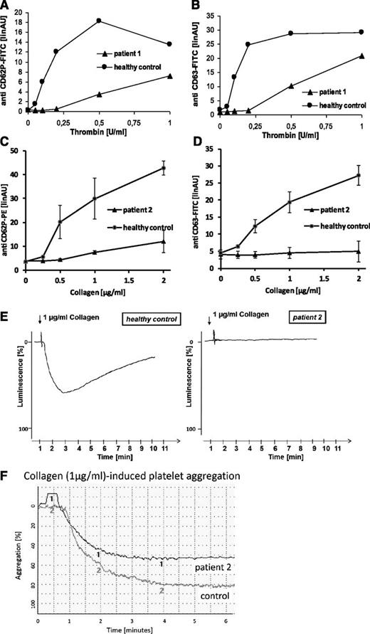 Figure 1. Platelet function analyses. Flow cytometric quantification of platelet granule secretion in platelet-rich plasma was stimulated using increasing concentrations of thrombin (0, 0.05, 0.1, 0.2, 0.5, and 1.0 U/ml) (A-B) or collagen (0, 0.25, 0.5, 1, and 2 µg/ml) (C-D). After fixation cells were washed and incubated with fluorescein isothiocyanate-conjugated anti-CD62 (A), phycoerythrin-conjugated anti-CD62 (C), or fluorescein isothiocyanate-conjugated anti-CD63 (B,D). Surface fluorescence was analyzed with a flow cytometer (FACSCalibur; Becton Dickinson). Data are expressed as linear arbitrary units. Analyses were performed with patients’ platelets and platelets from a healthy control. Platelet adenosine triphosphate release in response to collagen was monitored by lumiaggregometry in whole blood (E). Relative luminescence in percent was plotted as a function of time. Analyses were performed with platelets from patient 2 and platelets from a healthy control. Collagen-induced platelet aggregation of platelets from patient 2 and platelets from a healthy control was analyzed using a PAP4-aggregometer (F).