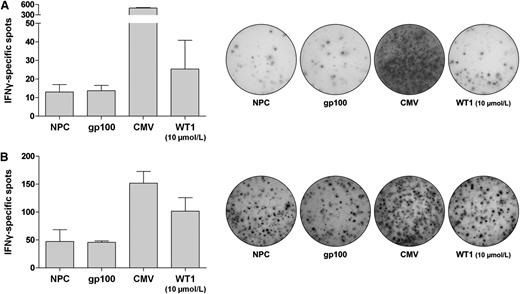 Figure 3. IFN-γ ELISPOT assay results. IFN-γ ELISPOT assay was performed using a commercially available kit according to the manufacturer’s instructions. PBMCs were resuspended in CTL medium and incubated for 48 hours (“Restore” protocol). Peptide-pulsed and irradiated T2 cells served as stimulator cells. Each error bar represents the standard deviation. (A) Representative subject UPN T64. (B) Representative subject UPN T14.