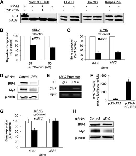Figure 1. IRF4 is highly expressed and drives Myc expression and proliferation in PTCL cell lines. (A) IRF4 expression was absent in normal resting T cells and was induced upon stimulation with PMA/ionomycin (PMA/I). This induction was blocked by the PKCβ inhibitor LY317615 (enzastaurin). PTCL cells constitutively expressed IRF4, and this expression was resistant to inhibition by LY317615. (B) siRNA-based knockdown of IRF4 inhibited cell proliferation (25 nM siRNA, P < .0001; 50 nM siRNA, P < .0001) in Karpas 299 (B); IRF4 (P = .0009) and MYC (P = .0048) gene expression in Karpas 299 (C); and IRF4 and MYC protein expression in Karpas 299 (D). (E) ChIP for IRF4 demonstrated binding to the MYC promoter in Karpas 299 cells. (F) Overexpression of IRF4 increased MYC promoter activity in Karpas 299 (luciferase assay, P = .0032). (G) MYC knockdown did not inhibit IRF4 gene expression (P = .91) (G), and had only minimal effect on IRF4 protein expression in Karpas 299 (H).
