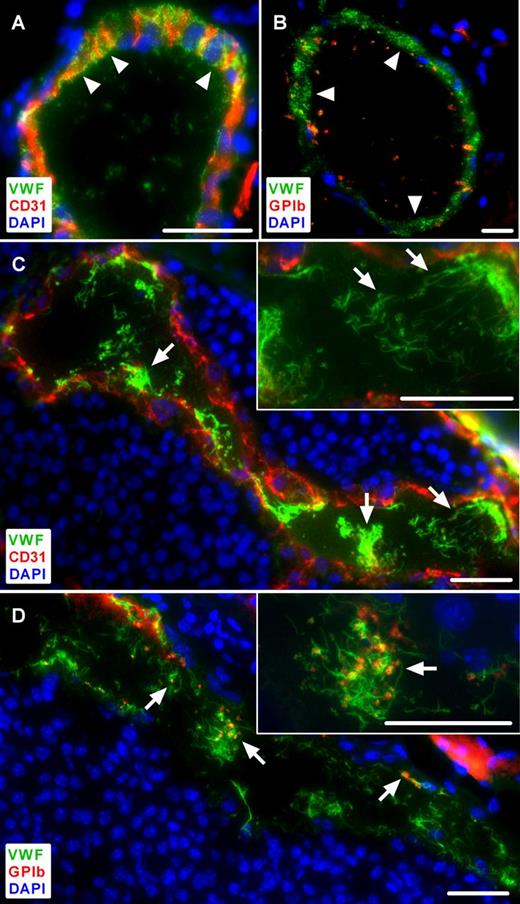 Figure 1. Immunofluorescence analysis of tumor microvessels compared with healthy control skin in ret transgenic mice. Cryosections were stained for VWF and CD31 (A,C). An anti-GPIb antibody was used to identify platelets (B,D). Nuclei were stained with DAPI. Representative images of control skin show VWF localized within the vessel wall, lacking ULVWF fibers within the lumen (A-B, arrowheads) and only few platelets are visible (B, red). By contrast, in tumor microvessels, ULVWF fibers are detectable within the vessel lumen indicating EC activation (C, arrows). These ULVWF fibers bind platelets as shown in the same vessel (D, red, arrows). Insets, A higher magnification of the presented images (n = 4 to 10 animals; scale bars = 20 µm). See also supplemental Figures 1-2.