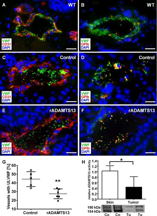 Figure 3. Reduced ADAMTS13 activity in tumor tissue promotes intraluminal VWF fiber formation in tumor microvessels. Immunofluorescence staining of cryosections for VWF (green), platelets (red), and the endothelial cell marker CD31 (red). DNA was stained with DAPI (blue). Mouse melanoma cells (Ret) were injected intradermally and mice were treated with recombinant ADAMTS13 (rADAMTS13; E-F) or 0.9% NaCl (C-D) as control. Reconstitution of ADAMTS13 reduced the formation of intraluminal ULVWF networks and platelet aggregation compared with vehicle treatment. In comparison with wild-type skin (A-B), less VWF in the vessel wall indicates ULVWF degradation after exocytosis (n = 5-6 animals; scale bars = 20 µm). To analyze the impact of ADAMTS13 on VWF fiber formation, vessels with or without luminal fibers were quantified. Infusion with rADAMTS13 significantly decreased the number of vessels with ULVWF (G). The activity and the protein expression of ADAMTS13 in tumor tissue were significantly reduced compared with healthy skin measured by a FRET-based assay and western blot (H; n = 3-5 animals, *P < .05, **P < .005). See also supplemental Table 2.