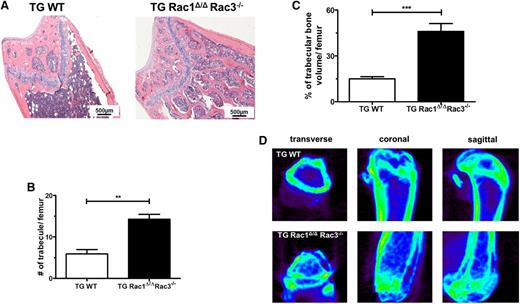 Figure 3. Deletion of Rac genes in perivascular space leads to abnormal trabecular bone formation in the medullary cavity. Femurs from TG WT and TG Rac1Δ/ΔRac3−/− TG Rac1Δ/ΔRac3−/− mice were prepared and quantification performed as detailed in Material and methods. (A) Hematoxylin and eosin staining of femurs of TG WT and TG Rac1Δ/ΔRac3−/− mice. The scale bar represents 500 μm. Photomicrographs were viewed at 40× original magnification using a Nikon Eclipse 80i microscope, and analyzed with NIS Elements Version 2BR imaging software. (B) Quantification of trabecular bone numbers and (C) trabecular bone volume in medullary cavity space. Data generated using NIS Elements AR software. Data represent mean ± SD, N = 3 animals per group, **P < .01, ***P < .001. (D) Micro-CT images of distal and proximal femoral trabecular bone structure in TG WT and TG Rac1 Δ/ΔRac3−/− mice.
