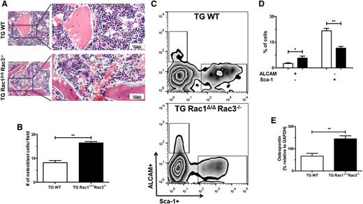 Figure 4. Deletion of Rac genes in Nestin+ cells leads to alterations in osteoblasts populations. (A) Photomicrographs of trabecular bone from mouse femurs after hematoxylin and eosin staining demonstrating osteoblasts (white arrow) recognized as basophilic cells with a cuboidal-columnar shape, arranged in rows along trabecular bone and the inner surface of BM space, and lining osteoblasts presenting a flat shape, lining the bone surface cells (*). The right panel shows expanded views of the boxed area on left. The scale bar represents 100μm; images were viewed at 200× original magnification using a Nikon Eclipse 80i microscope, and analyzed with NIS Elements Version 2BR imaging software. (B) The number of morphologically-defined osteoblasts was quantified from representative animals of each genotype. Data represent mean ± SD, N = 3 animals per group, **P < .01. (C) FACS gating strategy to define osteoblast progenitor cell populations by Sca-1 and ALCAM staining. (D) Percentages of ALCAM and Sca-1–expressing cells in live CD45/CD31/Ter119– BM-associated cell fractions. Data represent mean ± SD, *P < .05, **P < .01, N = 4 individual experiments. (E) Comparison of mRNA levels of HSCs maintenance genes and osteopontin (Opn) from freshly sorted Nestin+ cells from TG WT and TGRac1Δ/Δ/Rac3−/− mice by real-time PCR. Data represent mean ± SD, N = 3 individual experiments, **P < .01.