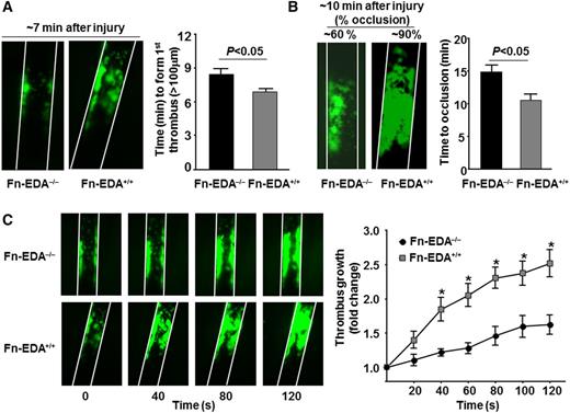 Figure 1. Cellular Fn-EDA+ promotes carotid artery thrombosis. Representative microphotographs and corresponding graphs showing quantitative analysis of time to first thrombus formation (A), time to occlusion (B), and thrombus growth (C) in FeCl3-injured carotid arteries as visualized by upright intravital microscopy. Platelets were labeled with calcein green. White lines delineate the arteries. *P < .05 compared with Fn-EDA−/− mice. Data are presented as mean ± SEM. N = 9 to 10 mice per group.