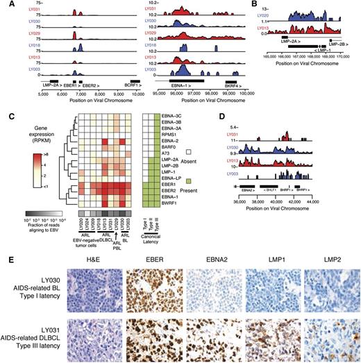 Figure 2. Transcriptional regulation of EBV gene expression demonstrates diversity of latency types. (A) Gene expression is shown as read counts per million reads aligned (y-axis) at canonical type I latency genes EBER1, EBER2, and EBNA1. Rows show individual samples and are colored alternating red/blue to emphasize sample-track pairing. (B) Immunogenic viral genes associated with type II and III latency are also expressed, such as LMP1. (C) EBV gene expression is highly diverse across ARL samples. The heatmap shows gene expression profiles of latency-associated genes (y-axis) across samples (x-axis). Gene expression is in units of RPKM normalized by fraction of reads aligning to EBV (“Methods”). (D) Genes associated with lytic reactivation, such as transcripts at the BamHI H locus, were expressed in primary ARL tumor samples. (E) Immunohistochemical staining for viral proteins EBNA2 and LMP1 was used to classify viral gene expression latency in ARL cases. A BL sample with latency I (upper) and a DLBCL sample with latency III (lower) are representative examples. A complete analysis can be found in Table 2.