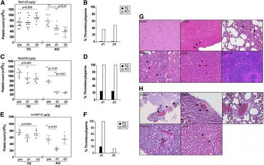 Figure 6. Platelet counts and histology analysis of major organs of mice after being challenged with Stx-2 or rmVWF. Platelet counts in TG and KO before (pre) and 24 (d1) and 72 (d3) hours after being challenged with Stx-2 at the dose of 50 pg/g (A) and 250 pg/g body weight (C), or with rmVWF at the dose of 5 μg/g body weight (E). ANOVA was used to determine the statistical significance of the differences among various groups. **P < .01. (B,D,F) Percentages of mice in A, C, and E having a 30% reduction of platelet counts from the baseline. (G-H) Representative images of hematoxylin and eosin staining demonstrating the occlusive thrombi in the brain, heart, lung, kidneys, and liver obtained from KO mice that died after being challenged by high doses of Stx-2 and rmVWF. The digital images were taken under light microscope with magnification ×200.