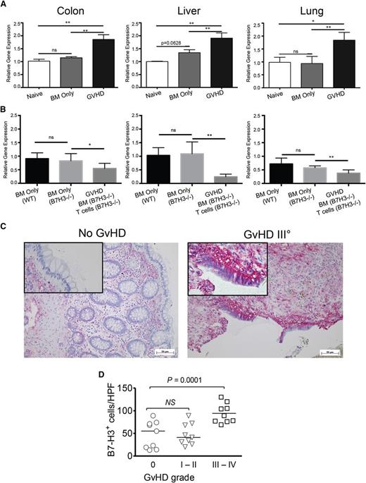 Figure 1. B7-H3 expression is upregulated in target organs during acute GVHD. (A) B6-WT mice were lethally irradiated and infused with 107 BALB/c non-T-cell–depleted (NTCD) BM with or without 2 × 106 BALB/c-purified T cells (3 experiments were performed). (B) BALB/c mice were lethally irradiated and infused with 107 B6-WT BM only, B7-H3−/− BM only, or B7-H3−/− BM plus 1 × 106 purified B7-H3−/− T cells. Mice were euthanized on day 21 after transplantation, and the colon, liver, and lung were examined for B7-H3 mRNA by qPCR. Two experiments were performed with 5 mice per group per experiment; 1 representative experiment is depicted. (C) Representative colon sections of a patient without GVHD (left) and a patient with intestinal GVHD grade 4 (right) are shown. Red signal: detection of B7-H3+ cells. (D) Quantification of B7-H3 staining in intestinal sections from multiple patients is shown. *P < .05; **P < .01. ns, not significant. HPF, high power field.
