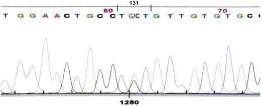 Figure 5. Nucleotide sequence of polymerase chain reaction product for κ light-chain DNA showing heterozygosity at cDNA position 403 with both cytosine and guanine, giving coding sequence for cysteine (TGT) and serine (TCT) at position 131.