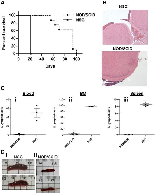 Figure 2. 018Z human pre-B-ALL cells induce isolated CNS leukemia in NOD/SCID mice and combined CNS/peripheral leukemia in NSG mice. (A) A Kaplan-Meier survival curve of NOD/SCID (n = 10) and NSG (n = 4) mice injected intravenously with 018Z cells (P = .001; log-rank test). (B) Representative hematoxylin and eosin staining of brain sections from NOD/SCID (lower; n = 10) and NSG (upper; n = 3) mice presenting leukemia infiltration in the subarachnoid space. (C) Flow cytometry analysis of peripheral leukemia percentage in the (i) blood, (ii) BM, and (iii) spleen using antibodies for CD10 and CD19. Values are means ± SE (P < .0001; unpaired t test). (D) Representative pictures of spleens taken from (i) NSG or (ii) NOD/SCID mice.