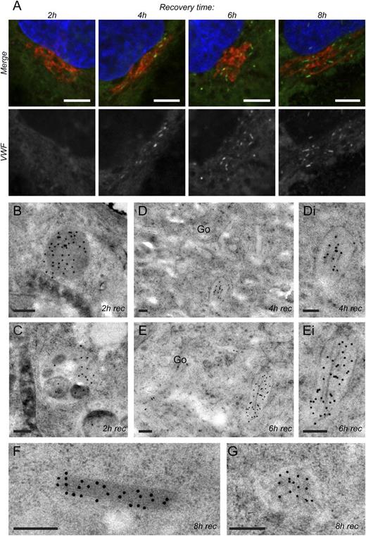 Figure 1. Formation of WPBs in HUVECs after PMA stimulation. HUVECs stimulated with PMA were washed with medium and were left to recover for 2 to 8 hours. (A) Immuno-fluorescent labeling for VWF (VWF-FITC, green channel), the trans-Golgi network (TGN 46 Alexa 568, red channel), and the nucleus (4′,6-diamidino-2-phenylindole, dihydrochloride, blue channel) after 2, 4, 6, and 8 hours of recovery. We found that the cells were devoid of WPBs after 2 hours of recovery. We followed the production of new WPBs from that time point onward. (B-G) VWF-specific immunogold labeling on TEM samples prepared after 2, 4, 6, and 8 hours of recovery. Gold particles are 15 nm in size. (B-C) Immuno-gold labeled structures found after 2 hours of recovery. (B) Large vesicle found close to the cell membrane that contains VWF specific immunogold label. (C) Lysosome-like structure showing VWF specific immunolabeling. (D-Di) Immature WPBs positively labeled for VWF near the Golgi apparatus (Go) that was found in TEM samples prepared after 4 hours of recovery. (E-Ei) A more advanced immature WPB positively labeled for VWF that was found close to the Golgi (Go) in TEM samples prepared after 6 hours of recovery. In this WPB, longer VWF tubules are observed compared with the 4-hour condition. (F) Condensed mature WPBs found after 8 hours of recovery. (G) VWF-containing vesicle found after 8 hours of recovery that appears to contain disorganized VWF tubules. Scale bars: (A) 5 µm; (B-G) 250 nm. Fluorescence images were acquired using a Leica SP5 or Leica SP8 confocal with a ×63 oil immersion objective with a numerical aperture of 1.4. Fluorochromes used are FITC (conjugated to sheep anti-VWF antibodies, green), Alexa 568 (conjugated to goat anti-rabbit antibodies, red), and DraQ5 (blue). Electron micrographs were acquired using an FEI Tecnai 12 at 120 kV and using an FEI Eagle 4k × 4k CCD camera.
