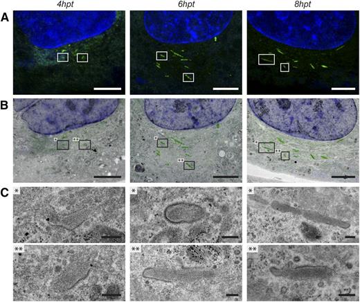 Figure 2. Correlative light and electron microscopy on forming WPBs in propeptide-EGFP transfected HUVECs. HUVECs transfected with propeptide-EGFP were fixed at several time points after transfection for CLEM. (A) Fluorescence images of HUVECs showing forming WPBs 4, 6, and 8 hours after transfection (hpt) (green channel). The nuclei were stained with DraQ5 (blue channel). The presented images are maximum intensity projections of deconvoluted z-stacks. The boxed WPBs represent 2 examples that were correlated to the corresponding TEM sample as shown in B and C. (B) Overlay of the fluorescence image shown in A and the electron micrograph of a corresponding TEM section. Boxes with asterisks represent 2 examples of WPBs in which the morphology is shown in C. (C) Electron micrographs of correlated WPBs. After 4 hours of transfection, the immature WPBs display a very electron lucent lumen. After 6 and 8 hours of transfection, the WPB lumen becomes more condensed. Also the VWF tubules become more visible within the lumen of the WPB. Scale bars: (A-B) 5 µm; (C) 250 nm. Fluorescence images were acquired using a Leica SP5 confocal with a ×63 oil immersion objective with a numerical aperture of 1.4. Fluorochromes used are EGFP tagged to the propeptide of VWF (propeptide-EGFP, green) and DraQ5 (blue). Deconvolution of the confocal images was performed using Huygens Pro. Electron micrographs were acquired using an FEI Tecnai 12 at 120 kV and using an FEI Eagle 4k × 4k CCD camera. Overlays as shown in B were prepared in Adobe Photoshop CS6.