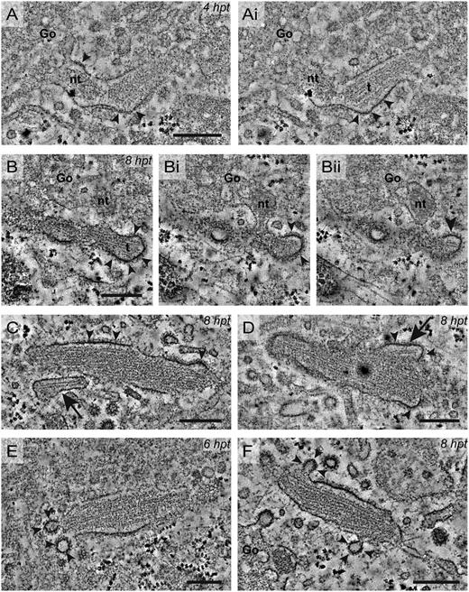 Figure 5. WPB growth is achieved by adding nontubulated VWF to the vesicle lumen. WPB elongation and condensation occurs by clathrin-mediated membrane remodeling. Electron tomograms of WPBs localized by CLEM revealed insights in mechanisms that seem to contribute to WPB growth, elongation, and membrane remodeling. (A-Ai) Tomogram sections of a WPB formed 4 hours after transfection (hpt). In the transition from Golgi to the forming WPB, a dense cluster of nontubulated VWF is observed, whereas VWF in the WPB lumen is tubulated (t). Also note the clathrin coat on the membrane of the WPB (arrowheads). (B-Bii) Tomogram sections of a WPB 8 hpt. In the Golgi, a dense cluster of nontubulated VWF is visible, which seems to be delivered to the forming WPB via the connection visible between the Golgi and WPB membrane. In the WPB tubules of VWF (t) are observed. The arrowheads indicate the extensive clathrin coat observed on the WPB membrane. This WPB is also presented in Figiugre 4E-Ei. (C) Tomogram section of a WPB 8 hpt. Close to the WPB, a small vesicle is observed that contains one tubule (arrow). On the WPB membrane, an extensive clathrin coat is observed (arrowheads). (D) Tomogram section of a WPB 8 hpt. The irregular shaped membrane (arrow) suggests fusion between the WPB and vesicles as shown in C. Also, an abundant clathrin coating (arrowheads) was observed on the WPB membrane. (E) Tomogram section of a WPB 6 hpt. In the WPB membrane, clathrin-coated pits are observed (arrowheads), which suggest clathrin-mediated compensatory membrane retrieval. (F) Tomogram section of a WPB 8 hpt close to the Golgi apparatus. On the WPB membrane, more pronounced clathrin-coated pits are observed as indicated by the arrowheads. Scale bars: 250 nm. Tilt series for tomography were acquired using an FEI Tecnai 12 at 120 kV and using an FEI Eagle 4k × 4k CCD camera. Tilt series for tomography were collected with SerialEM. Tomogram reconstructions were performed in IMOD. Go, Golgi; nt, nontabulated.