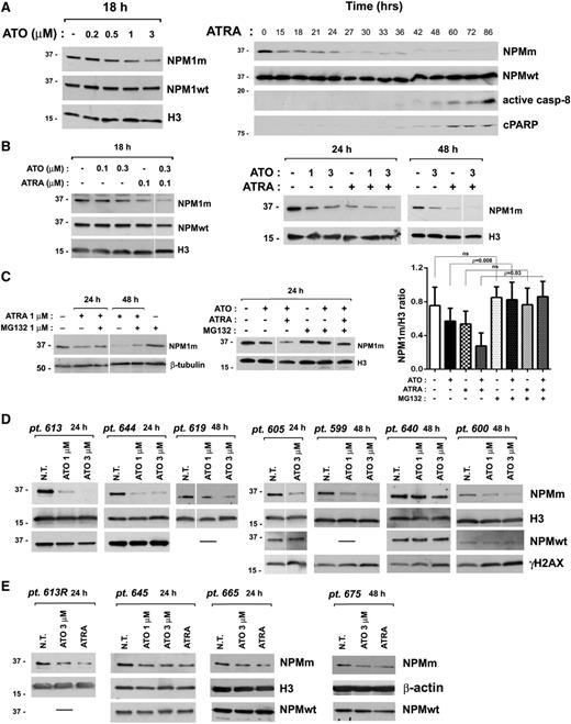 Figure 4. ATO/ATRA induce proteasome-dependent NPM1 mutant oncoprotein downregulation. (A) Western blot analysis of NPMm and NPMwt protein levels upon ATO (left) and ATRA (right) treatment in OCI/AML3. Active caspase-8 and cleaved PARP (cPARP) indicate apoptosis activation (right). (B) Western blot analysis of NPM1 mutant and wild-type protein levels upon ATO, ATRA, and ATO/ATRA combination at lower (left) and higher doses (right) in OCI/AML3. (C) Analysis by western blot of NPM1 mutant proteins levels upon ATO, ATRA, or ATO/ATRA combination on OCI/AML3 cells pretreated with proteasome inhibitor MG132. Band intensity quantification (NPM1 mutant/H3 ratio) from 3 independent experiments (mean ± SD). (A-C) Results are representative of at least 3 independent experiments. (D-E) Western blot analysis of the effects of ATO on NPM1 mutant protein levels in 11 primary NPM1-mutated AML patient cells. Downregulation of NPM1 mutant oncoprotein upon ATRA treatment in 4 NPM1-mutated AML patients is shown in panel E. Phosphorylation of histone H2AX (γH2AX) is expression of DNA damage. (A-E) Antibodies recognizing specifically the NPMm protein or NPMwt protein have been used, as described in “Methods.” Histone H3, β-tubulin, or β-actin expression was used as loading control. In all cases, membranes probed with the different antibodies were from the same gel. Vertical lines have been inserted in blot images to indicate repositioned lanes within the same gel.
