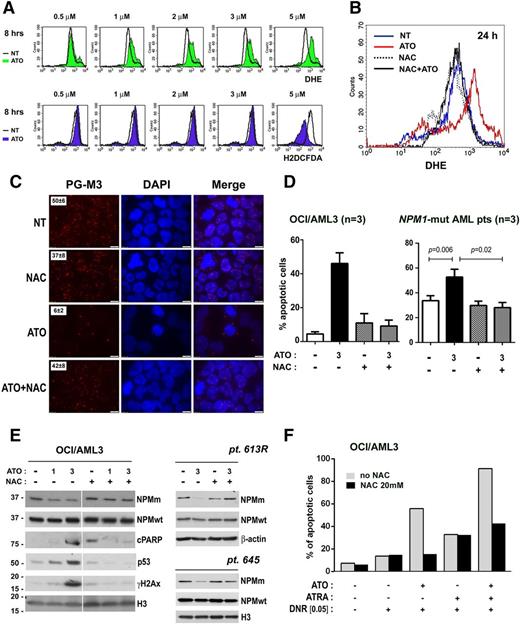 Figure 7. ROS mediate PML NB rearrangements, cell apoptosis, NPM1 mutant oncoprotein degradation, and chemosensitization to DNR upon ATO treatment. (A) Flow cytometric detection of ROS in OCI/AML3 upon ATO treatment (DHE, green histograms, upper; and H2DCFDA, violet histograms, lower) compared with untreated cells (black line). (B) Effect of NAC pretreatment on ATO-induced ROS (as detected by DHE) at 24 hours in OCI/AML3. Histograms show levels of fluorescence of treated cells (red, ATO 3 μM; dashed line, NAC 20 mM; black, NAC + ATO) as compared with untreated cells (blue). (C) PML immunofluorescence staining (PG-M3, secondary goat anti-mouse Alexa-Fluor 568, red) of cytospin preparations of OCI/AML3: untreated cells (NT), 16 hours NAC 20 mM pretreatment (NAC), 8 hours ATO 3 μM treatment (ATO), and NAC pretreatment + ATO treatment (NAC + ATO). NBs/cell count (mean ± SD, on 50 cells) is shown in the inset. (D) Apoptosis assay (Annexin V/7AAD) on OCI/AML3 (left) and primary NPM1-mutated AML cells (n = 3) (right): untreated cells (white), 24-hour ATO 3 μM treatment (black), 16-hour NAC 20 mM pretreatment (checked), and NAC pretreatment + ATO treatment (gray). Means ± SD. Two-tailed paired Student t test P values are indicated. (E) Effect of NAC pretreatment on NPM1-mutant degradation. Western blot analysis of NPMm and NPMwt protein levels in OCI/AML3 (left) and 1 primary NPM1-mutated AML patient sample (pt. 613R, right). Activation of apoptosis (cPARP), p53 upregulation, and DNA damage induction (γH2AX) in OCI/AML3 are also shown (left). Histone H3 or β-actin expression was used, respectively, as loading control. In all cases, membranes probed with the different antibodies were from the same gel. (F) Effect of NAC pretreatment on chemosensitization to DNR by ATO/ATRA. Apoptosis flow cytometric evaluation (7AAD/Annexin V) upon 24-hour DNR treatment (0.05 μM) in OCI/AML3 cell lines pretreated with ATO (3 μM), ATRA (1 μM), and ATO/ATRA for 24 hours, previous incubation with or without NAC 20 mM for 16 hours.
