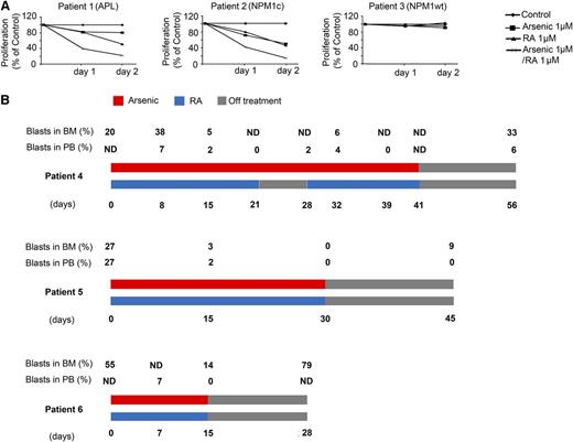 Figure 2. RA and arsenic induce growth inhibition in NPM1 mutated AML cells ex vivo and in vivo. (A) Primary AML cells from 3 different AML patients were treated with arsenic (1 μM), RA (1 μM) or a combination of both for 48 hours. Cell growth (percent of control) was assayed in duplicate wells. (B) Percent of PB and BM blasts and treatment schedule in 3 NPM1–mutated AML patients treated with RA and arsenic as indicated. ND, not done.