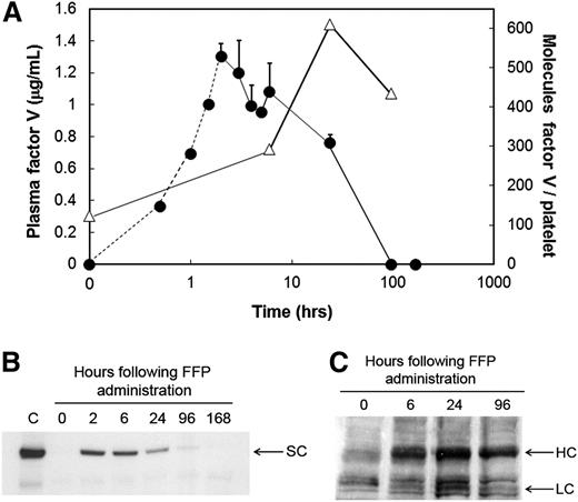 Figure 1. Quantification of plasma- and platelet-derived FV levels in an FV-deficient patient prior to and subsequent to administration of FFP. (A) Plasma-derived FV antigen and activity was measured prior to (time = 0 hours) and subsequent to FFP administration, at the times indicated, using a double antibody competitive radioimmunoassay (circles). The FV concentrations between 0 and 2 hours (circles, dashed line) were extrapolated based on the human FV turnover rate in a nonhuman primate model as described in “Study design.” Platelet-derived FV (triangles) was measured using a quantitative western blot described in “Study design” using washed platelets lysed with triton X-100 in the presence of leupeptin. Platelet lysates were treated with thrombin (2 U/mL, 10 minutes, 37°C) to convert all platelet-derived FV and its partial activation products to FVa. Following sodium dodecyl sulfate–polyacrylamide gel electrophoresis, immunoblotting was performed using a mixture of an anti-FV heavy chain and an anti-FV light chain monoclonal antibody. (B) FV in plasma was immunoblotted prior to (0 hours) and subsequent to FFP administration (6, 24, 96, and 168 hours) as described above. The position of single chain FV (SC) is indicated. C, plasma from an unaffected individual. (C) Platelet-derived FV was immunoblotted in whole platelet lysates following its conversion to FVa prior to (0 hours) and subsequent to FFP administration (6, 24, and 96 hours), as described above. The positions of the FVa heavy chain (HC) and light chain (LC) are indicated.