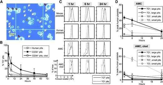 Figure 4. Characterization young vs old platelets. (A) Representative field of AMC EV-megakaryocyte preparation on a hematocytometer before infusion. White arrows represent some of the visible platelet-size particles. Red arrows indicate large megakaryocyte-like cells, whereas a large cell with extended proplatelets/platelets is shown in the center (yellow arrow). Bar in left lower corner indicates size of the observed field. (B) Temporal profile of the percent of a circulating platelet population that are TO+. Thin gray horizontal bar is percent TO+ recipient murine platelets. Open squares are percent of infused human platelets that are TO+. Black squares are percent of derived platelets from infused AMC EV-megakaryocytes that are TO+, and gray squares are the same when infused into clodronate liposome-pretreated mice. Mean ± SEM are shown. N ≥ 5 studies per arm. (C) Representative temporal profiles of size as determined by forward scatter for TO+ (solid lines) and TO− (dashed lines) platelets. Top row is recipient mice platelets after infused AMC EV-megakaryocytes. Second row is human platelets after infusion of donor platelets. Third and bottom row are human platelets derived from AMC EV-megakaryocytes without and with clodronate liposome pretreatment, respectively. (D) Graphs are percent of the maximum human platelet number (which occurred 1-hour after EV-megakaryocyte infusion) at each time point separated out by both TO staining and size. The AMC EV-megakaryocytes were infused into either mice that were untreated (top) or pretreated (bottom) with clodronate liposomes. Mean ± SEM are shown. N ≥ 5 studies per arm.