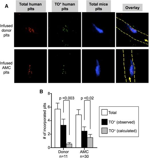 Figure 6. In situ studies of incorporation of TO+ vs TO− platelets into growing thrombi. (A) Representative confocal images after cremaster arteriole laser injuries in NSG mice done 0.5 to 1 hour after infusion of (top) human donor platelets or (bottom) AMC EV-megakaryocytes double-labeled with calcein violet (red) and TO (green) with double-labeled human platelets being yellow in the overlay (right). Incorporated murine platelets into the thrombi are in blue. In the overlay, the direction of flow is indicated by an arrow and the outline of the vessels by dashed yellow lines. (B) Mean ± SEM of total number of human platelets per thrombus (open bars), observed number of TO+ platelets per thrombus (black bars), and calculated number of TO+ platelets per thrombus based on the percent of human platelets in the circulation based on level of circulating human platelets determined on concurrent flow cytometric studies (gray bars). On the left are studies done after infused human donor platelets and on the right are the same after infused AMC EV-megakaryocytes.