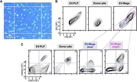 Figure 7. Analysis of AMC EV-PLP preparation. (A) Representative field of an EV-PLP preparation on a hematocytometer before infusion. Bar in left lower corner indicates size of the observed field. (B) Representative size distribution of particles of the total preparation as determined by forward-scatter (FS) vs side-scatter (SS) for (left) EV-PLPs, (center) donor platelets, and (right) EV-megakaryocytes. (C) Representative surface expression of human CD41 and CD42b done on the same samples as in B. Percent of cells in each of 4 quadrants are noted. The AMC-megakaryocytes total preparation was also fractionated and gave low CD41+ (blue, 25% of the total) and high CD41+ (magenta, 73% of total) size preparations.