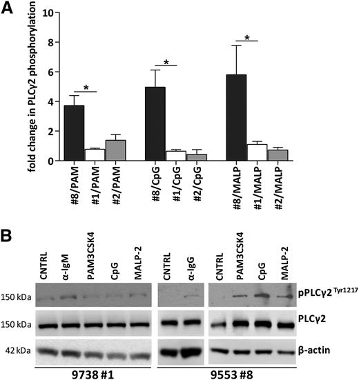 Figure 6. TLR ligands increase PLCγ2 phosphorylation in CLL subset #8 CLL but not in subsets #1 or #2. (A) Densitometric analysis of p-PLCγ2/PLCγ2 normalized to the unstimulated control, in CLL samples after stimulation with TLR ligands: PAM3CSK4, CpG ODN 2006, and MALP-2. The graphs represent the mean values in subsets #8, #1, and #2 CLL cases (5, 4, and 2 cases, respectively).*P < .05. (B) Representative western blot of a subset #8 case displaying increased PLCγ2 phosphorylation after stimulation with anti-IgG Ab and TLR ligands PAM3CSK4, CpG ODN 2006, and MALP-2, contrasting a nonresponding subset #1 case.