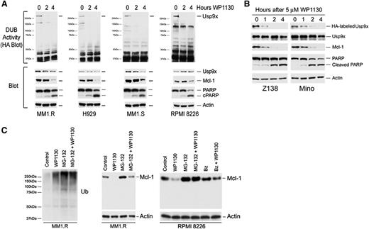 Figure 1. WP1130 inhibits DUB activity and reduces Mcl-1 protein expression in myeloma cells. (A) Myeloma cells (as indicated) were treated with 5 μM WP1130 for 0, 2, or 4 hours before DUB activity was assessed by hemagglutinin-ubiquitin vinylsulfone (HA-UbVS) labeling. The labeled DUBs were detected by immunoblotting with anti-HA antibody. HA-labeled Usp9x is denoted. The protein lysates were also immunoblotted for total Ub, Usp9x, Mcl-1, and PARP. β-actin was used as a protein loading control. (B) Z138 and Mino cells were treated as noted before cell lysates were screened for Usp9x activity (HA-labeled Usp9x), Usp9x, Mcl-1, PARP, and actin protein level by blotting. (C) Myeloma cells were treated with WP1130 alone or were pretreated for 30 minutes with proteasome inhibitors MG-132 (5 µM) or bortezomib (Bz) (50 nM) prior to WP1130 treatment. Lysates were prepared after 4 hours and immunoblotted for Ub and Mcl-1. Equal protein load was confirmed by immunoblotting with β-actin.
