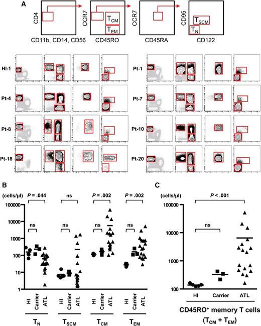 Figure 2. Identification and absolute numbers of 4 subpopulations—TN, TSCM, TCM, and TEM—divided from the CD4+ T cells of HTLV-1 carriers and ATL patients. (A) Top panels show a scheme to isolate the TN, TSCM, TCM, and TEM populations from PBMCs. After excluding dendritic cells, monocytes, and natural killer cells, we gated CD4+ cells and then separated into 4 subpopulations. The lower panels show representative data from a HI, a HTLV-1 carrier, and ATL patients. Additional data from other samples are presented in supplemental Figure 1. (B-C) Absolute numbers of each population (TN, TSCM, TCM, and TEM) or the CD45RO+ memory T-cell population (TCM + TEM) in peripheral blood from HIs (n = 5), HTLV-1 carriers (n = 3), and ATL patients (n = 17) were calculated with PBMC counts and fluorescence-activated cell sorting (FACS) analysis. Each value is presented in supplemental Table 4. P values by Dunn’s multiple comparisons test after Kruskal-Wallis test are presented. Bars indicate means.